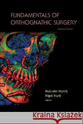 Fundamentals of Orthognathic Surgery Malcolm Harris 9781860949944  - książka