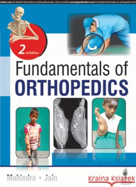 Fundamentals of Orthopedics Mukul Mohindra Jitesh Kumar Jain  9789352701322 Jaypee Brothers Medical Publishers - książka