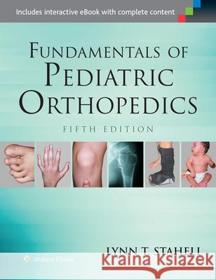 Fundamentals of Pediatric Orthopedics Lynn T. Staheli 9781451193930 Lippincott Williams & Wilkins - książka