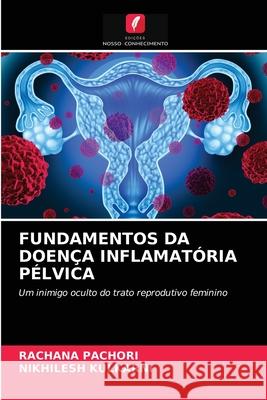 Fundamentos Da Doença Inflamatória Pélvica Rachana Pachori, Nikhilesh Kulkarni 9786203300659 Edicoes Nosso Conhecimento - książka