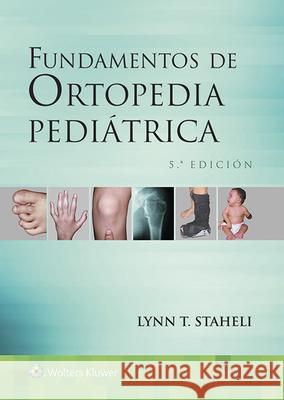 Fundamentos de Ortopedia Pediátrica Staheli, Lynn T. 9788416654482 LWW - książka
