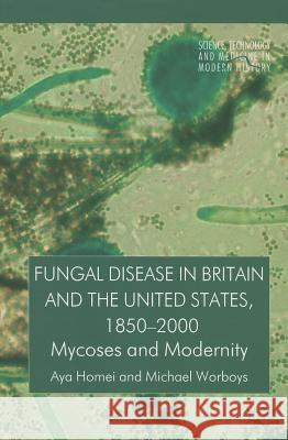 Fungal Disease in Britain and the United States 1850-2000: Mycoses and Modernity Homei, A. 9781137392633 Palgrave MacMillan - książka