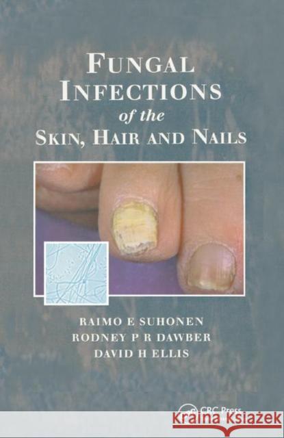 Fungal Infections of the Skin and Nails Raimo E. Suhonen, Rodney P.R. Dawber, David H. Ellis 9780367399733 Taylor and Francis - książka