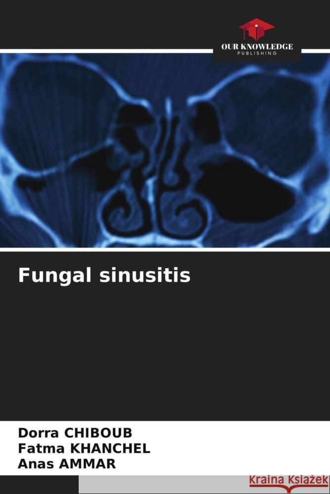 Fungal sinusitis CHIBOUB, Dorra, khanchel, Fatma, AMMAR, Anas 9786205421949 Our Knowledge Publishing - książka