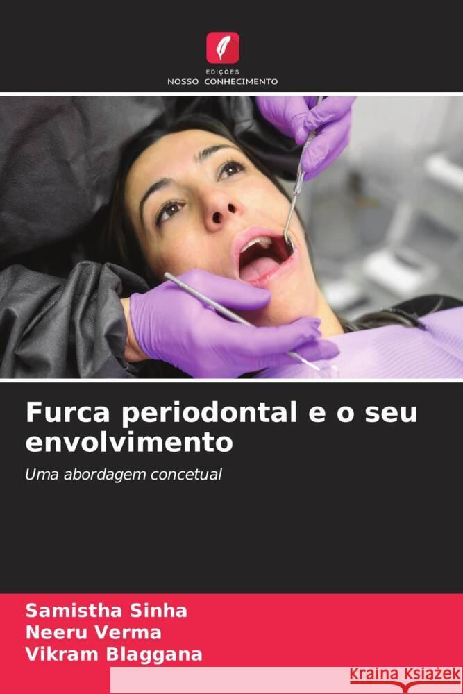 Furca periodontal e o seu envolvimento Sinha, Samistha, Verma, Neeru, Blaggana, Vikram 9786206528654 Edições Nosso Conhecimento - książka