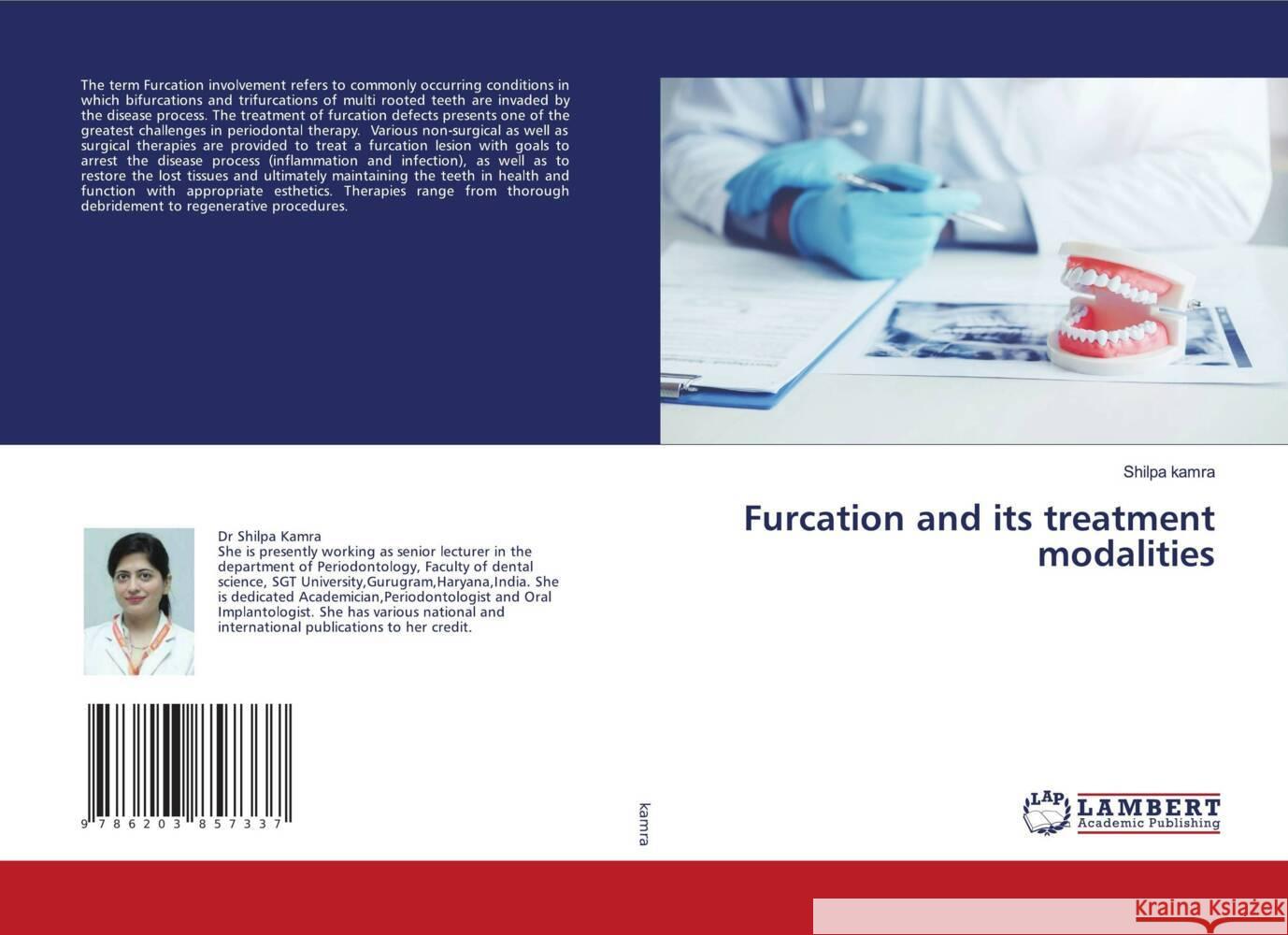 Furcation and its treatment modalities kamra, Shilpa 9786203857337 LAP Lambert Academic Publishing - książka