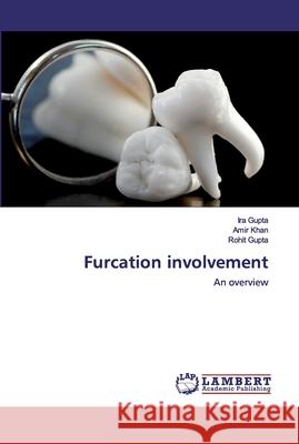 Furcation involvement Gupta, Ira 9786202531863 LAP Lambert Academic Publishing - książka