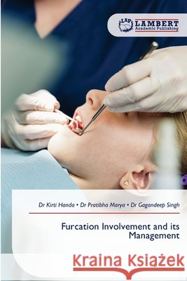 Furcation Involvement and its Management Kirti Handa Pratibha Marya Gagandeep Singh 9786630245417 LAP Lambert Academic Publishing - książka