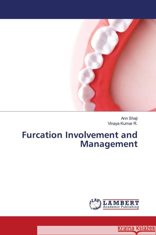 Furcation Involvement and Management Shaji, Ann, Kumar R., Vinaya 9786205497562 LAP Lambert Academic Publishing - książka