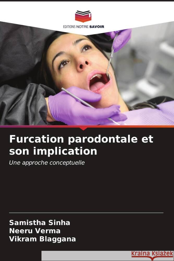 Furcation parodontale et son implication Sinha, Samistha, Verma, Neeru, Blaggana, Vikram 9786206528630 Editions Notre Savoir - książka