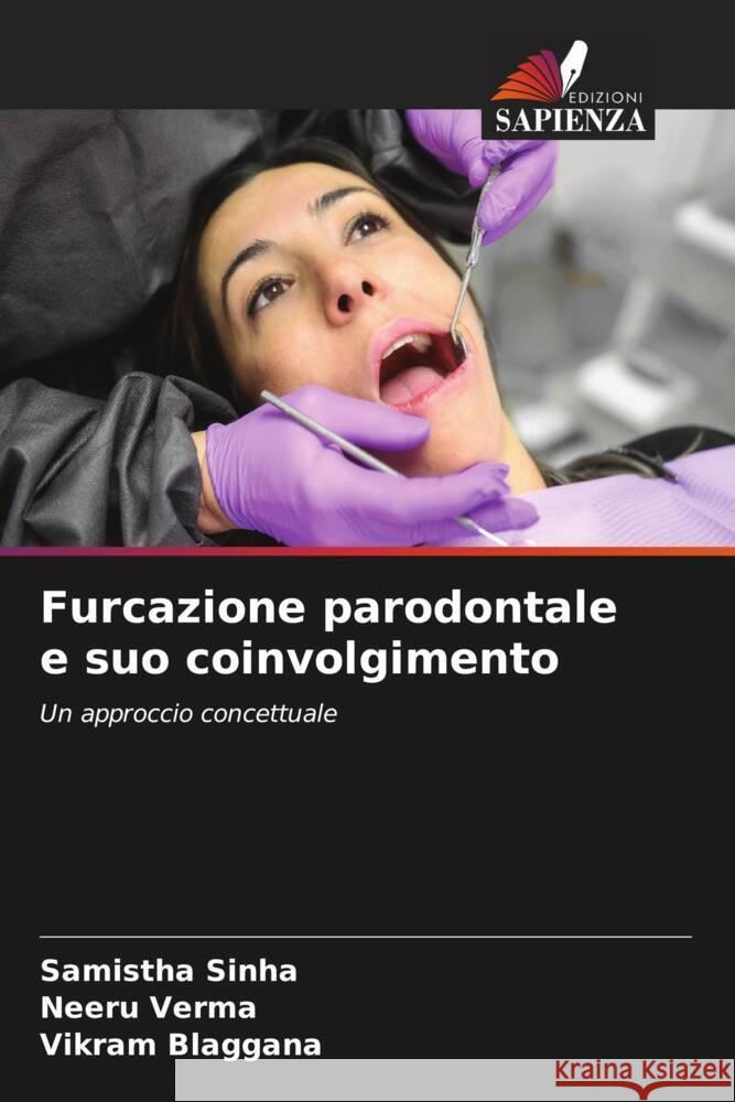 Furcazione parodontale e suo coinvolgimento Sinha, Samistha, Verma, Neeru, Blaggana, Vikram 9786206528647 Edizioni Sapienza - książka