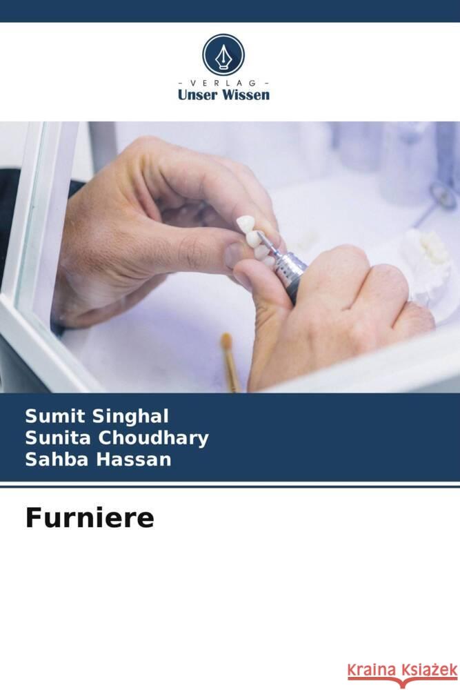 Furniere SINGHAL, SUMIT, Choudhary, Sunita, Hassan, Sahba 9786208317072 Verlag Unser Wissen - książka