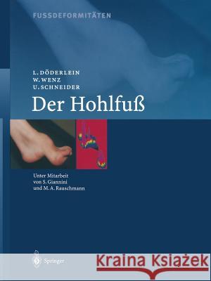 Fussdeformitäten: Der Hohlfuss Giannini, S. 9783642630996 Springer - książka