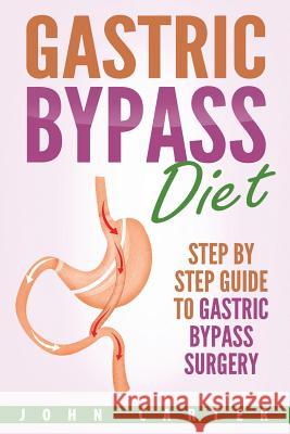 Gastric Bypass Diet: Step By Step Guide to Gastric Bypass Surgery John Carter 9781951103644 Guy Saloniki - książka