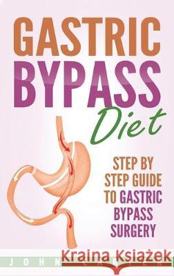 Gastric Bypass Diet: Step By Step Guide to Gastric Bypass Surgery John Carter 9781951404376 Guy Saloniki - książka