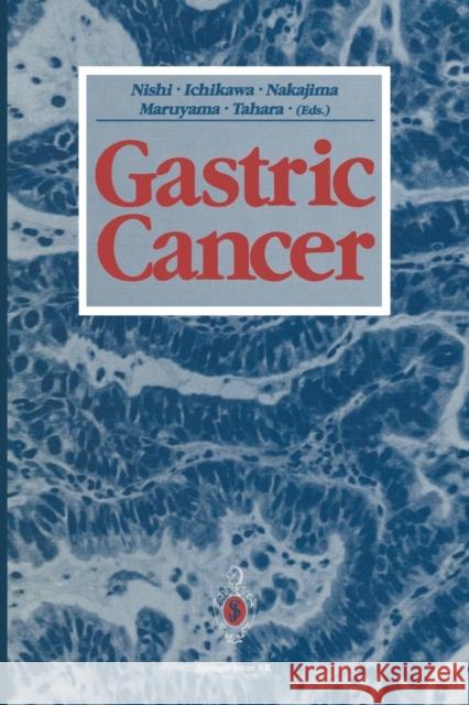 Gastric Cancer Mitsumasa Nishi Heizaburo Ichikawa Toshifusa Nakajima 9784431683308 Springer - książka