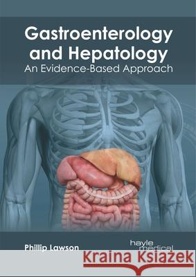 Gastroenterology and Hepatology: An Evidence-Based Approach Phillip Lawson 9781632416155 Hayle Medical - książka