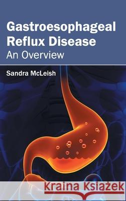 Gastroesophageal Reflux Disease: An Overview Sandra McLeish 9781632412256 Hayle Medical - książka