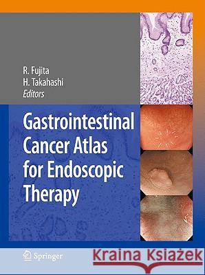 Gastrointestinal Cancer Atlas for Endoscopic Therapy Rikiya Fujita Hiroshi Takahashi 9784431881643 Springer - książka