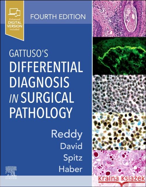 Gattuso's Differential Diagnosis in Surgical Pathology Vijaya B. Reddy Odile David Daniel J. Spitz 9780323661652 Elsevier - książka