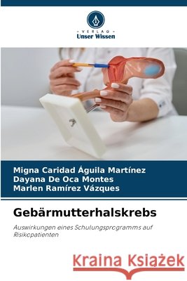 Gebärmutterhalskrebs Águila Martínez, Migna Caridad, De Oca Montes, Dayana, Ramírez Vázques, Marlen 9786208983529 Verlag Unser Wissen - książka