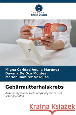 Gebärmutterhalskrebs Águila Martínez, Migna Caridad, De Oca Montes, Dayana, Ramírez Vázques, Marlen 9786208983529 Verlag Unser Wissen - książka