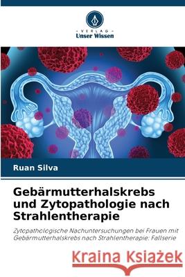 Geb?rmutterhalskrebs und Zytopathologie nach Strahlentherapie Ruan Silva 9786207740932 Verlag Unser Wissen - książka