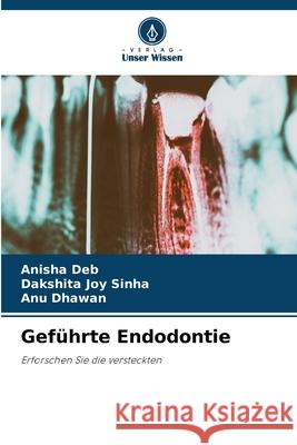 Gef?hrte Endodontie Anisha Deb Dakshita Joy Sinha Anu Dhawan 9786207547128 Verlag Unser Wissen - książka