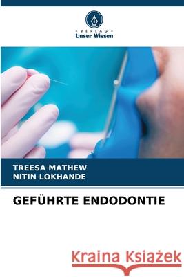 GEFÜHRTE ENDODONTIE MATHEW, TREESA, Lokhande, Nitin 9786208711108 Verlag Unser Wissen - książka