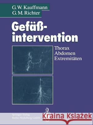 Gefäßintervention: Thorax, Abdomen, Extremitäten Allenberg, J. -R 9783662073995 Springer - książka