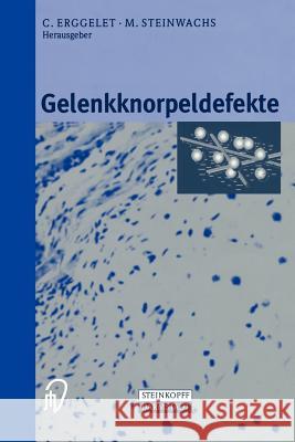 Gelenkknorpeldefekte C. Erggelet M. Steinwachs 9783798512658 Steinkopff-Verlag Darmstadt - książka