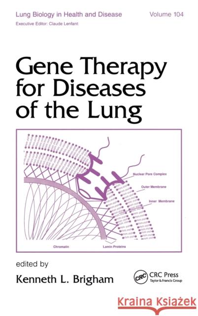 Gene Therapy for Diseases of the Lung Kenneth Brigham Brigham Brigham Kenneth Brigham 9780824700607 CRC - książka