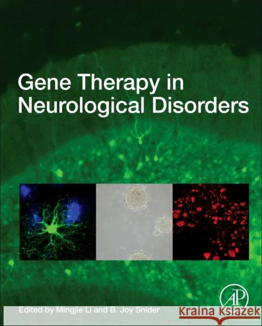 Gene Therapy in Neurological Disorders Mingjie Li B. Joy Snider 9780128098134 Academic Press - książka