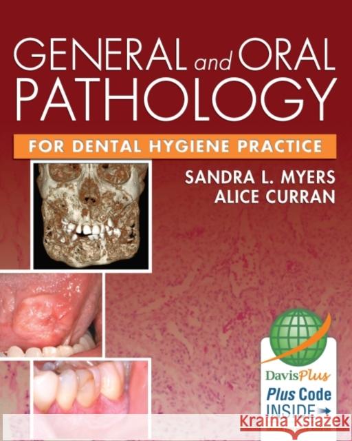 General and Oral Pathology for Dental Hygiene Practice 1e Sandra L. Myers Alice Curran 9780803625778 F. A. Davis Company - książka