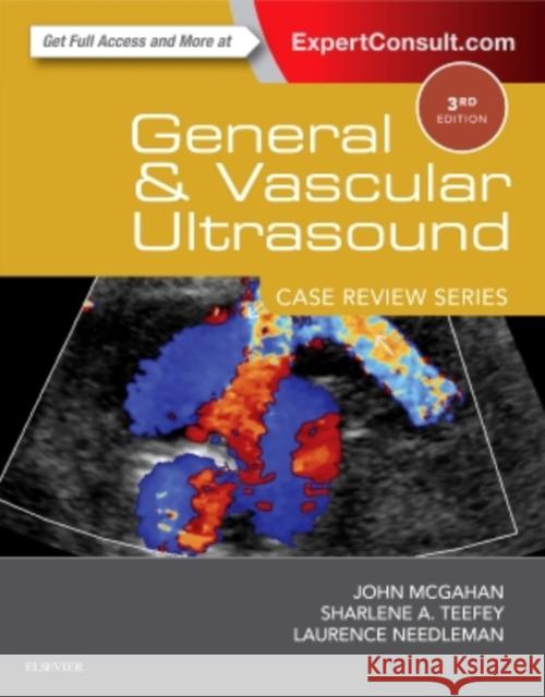 General and Vascular Ultrasound: Case Review John P. McGahan 9780323296144 Elsevier Science - książka