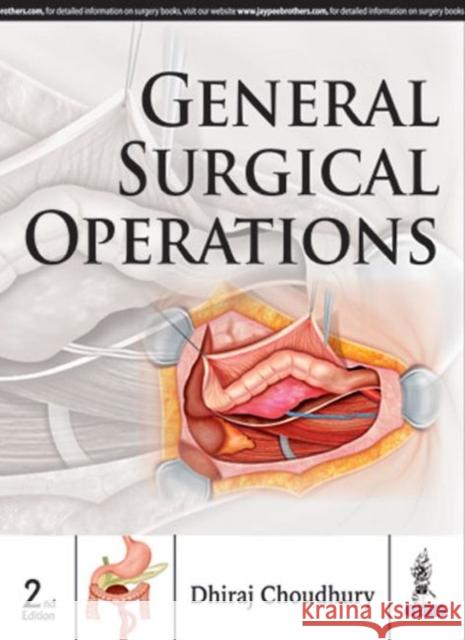 General Surgical Operations Dhiraj Choudhury 9789351525202 Jaypee Brothers, Medical Publishers Pvt. Ltd. - książka