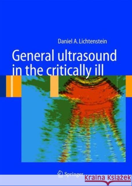 General Ultrasound in the Critically Ill Lichtenstein, Daniel A. 9783540736233 SPRINGER-VERLAG BERLIN AND HEIDELBERG GMBH &  - książka