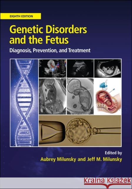 Genetic Disorders and the Fetus: Diagnosis, Prevention and Treatment Aubrey Milunsky Jeff M. Milunsky 9781119676935 Wiley-Blackwell - książka