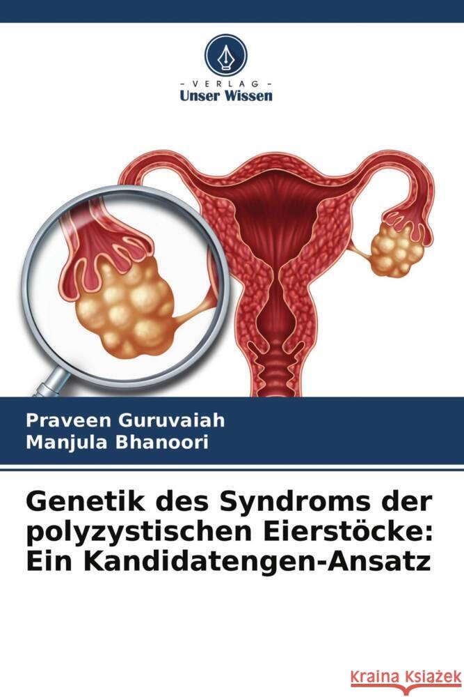 Genetik des Syndroms der polyzystischen Eierstöcke: Ein Kandidatengen-Ansatz Guruvaiah, Praveen, Bhanoori, Manjula 9786204706719 Verlag Unser Wissen - książka