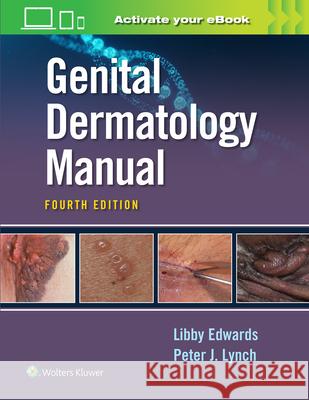 Genital Dermatology Manual Elizabeth Edwards Peter Lynch 9781975161453 LWW - książka