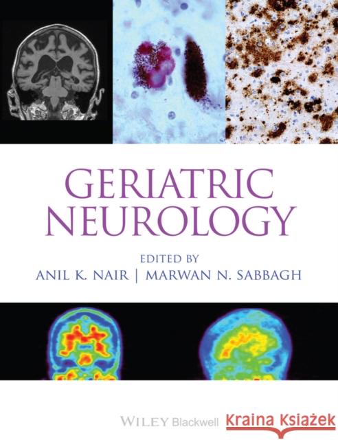 Geriatric Neurology  9781118730683 John Wiley & Sons - książka