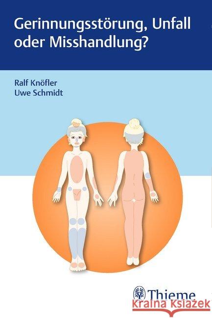 Gerinnungsstörung, Unfall oder Misshandlung? : Diagnostische Differenzierung unklarer Blutungsbefunde bei Kindern  9783132427693 Thieme - książka