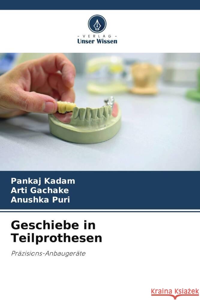 Geschiebe in Teilprothesen Kadam, Pankaj, GACHAKE, ARTI, PURI, ANUSHKA 9786205162354 Verlag Unser Wissen - książka