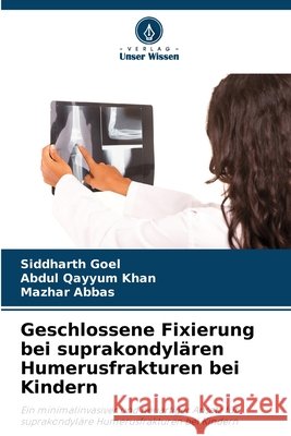 Geschlossene Fixierung bei suprakondylären Humerusfrakturen bei Kindern Goel, Siddharth, Khan, Abdul Qayyum, Abbas, Mazhar 9786209395109 Verlag Unser Wissen - książka