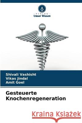 Gesteuerte Knochenregeneration Shivali Vashisht Vikas Jindal Amit Goel 9786205619506 Verlag Unser Wissen - książka