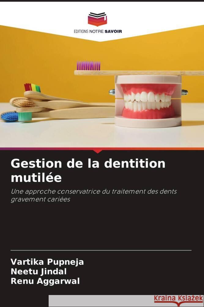 Gestion de la dentition mutilée Pupneja, Vartika, Jindal, Neetu, Aggarwal, Renu 9786205180624 Editions Notre Savoir - książka