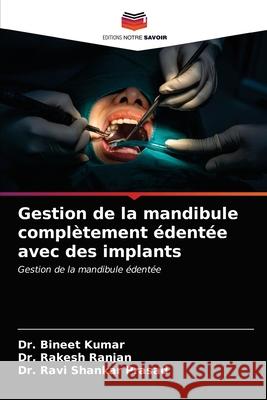 Gestion de la mandibule complètement édentée avec des implants Kumar, Bineet 9786203662368 Editions Notre Savoir - książka