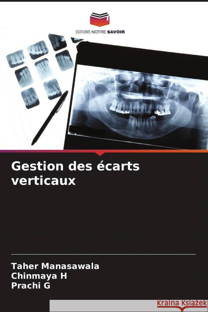 Gestion des écarts verticaux Manasawala, Taher, H, Chinmaya, G, Prachi 9786204467795 Editions Notre Savoir - książka
