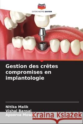 Gestion des cr?tes compromises en implantologie Nitika Malik Vishal Bansal Apoorva Mowar 9786207690893 Editions Notre Savoir - książka