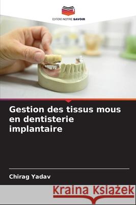 Gestion des tissus mous en dentisterie implantaire Chirag Yadav 9786207615216 Editions Notre Savoir - książka